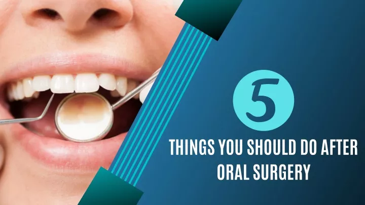 things you should do after oral surgery