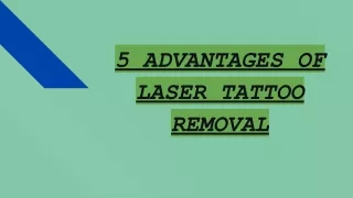 Top 5 Advantages of Laser Tattoo Removal