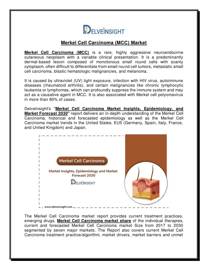 merkel cell carcinoma mcc market