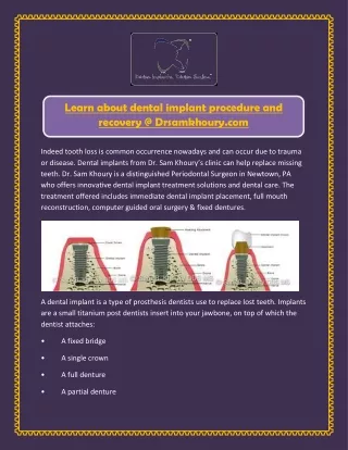 learn about dental implant procedure and recovery