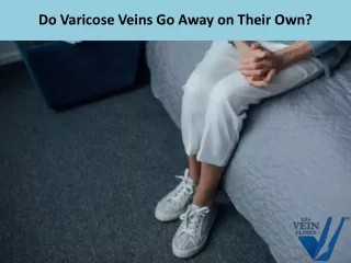 do varicose veins go away on their own