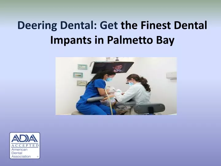 deering dental get the finest dental impants in palmetto bay