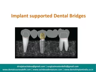 Implant supported Dental Bridges - dentalimplantindia