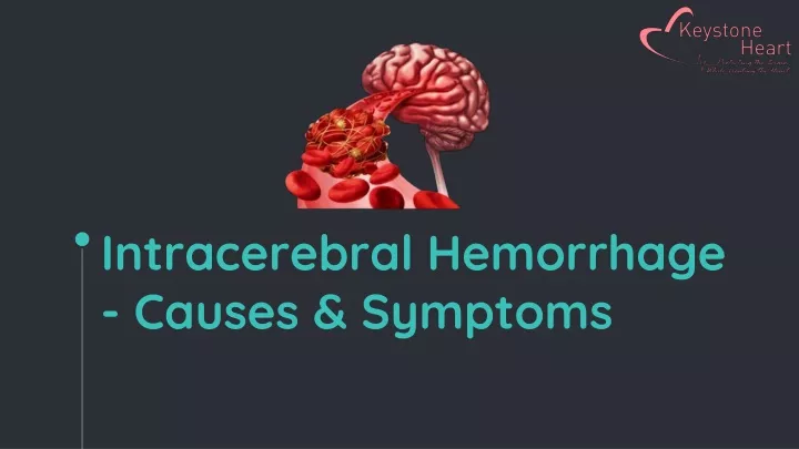 intracerebral hemorrhage causes symptoms