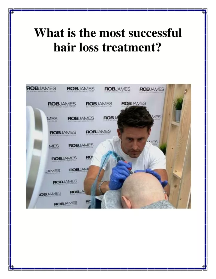 what is the most successful hair loss treatment