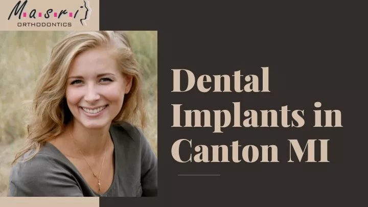 dental implants in canton mi