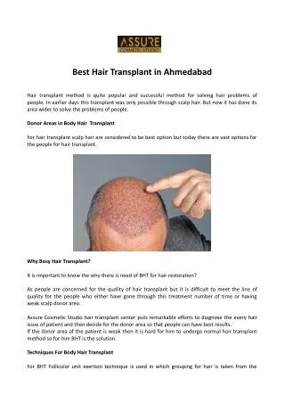 Best Hair Transplant in Ahmedabad
