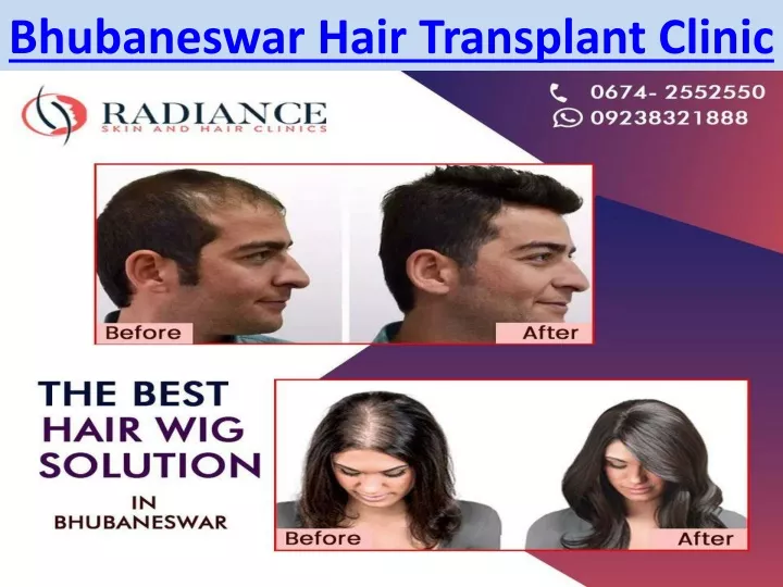 bhubaneswar hair transplant clinic