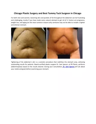 Chicago Plastic Surgery and Best Tummy Tuck Surgeon in Chicago