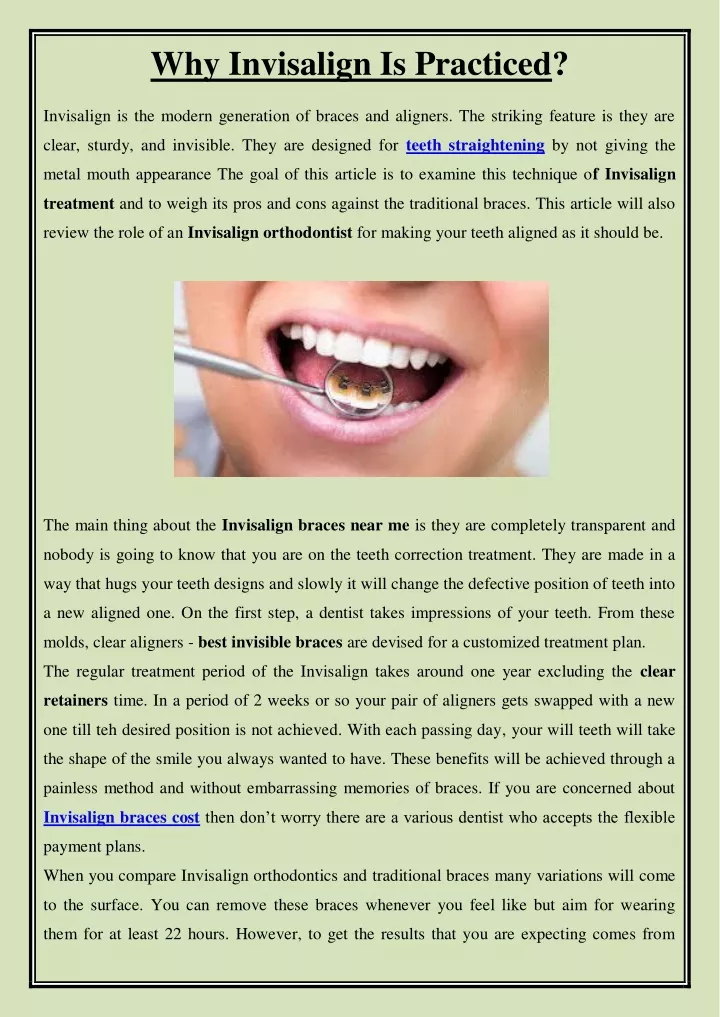 why invisalign is practiced