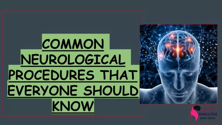 common neurological procedures that everyone should know