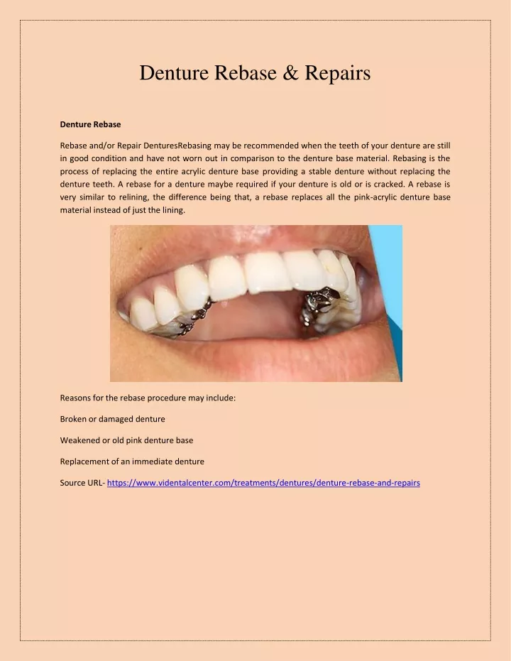 denture rebase repairs