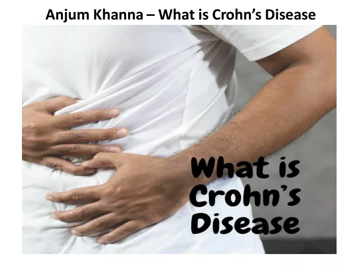 anjum khanna what is crohn s disease