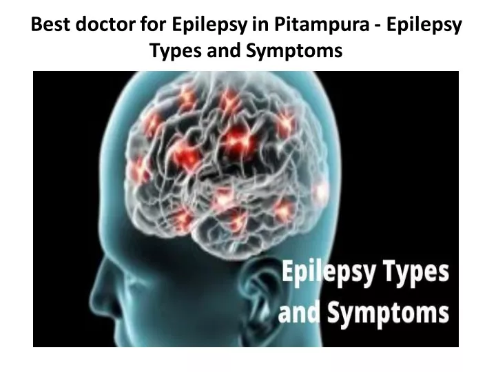 best doctor for epilepsy in pitampura epilepsy