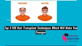 5 FUE Hair Transplant Techniques Which Will Make You Younger