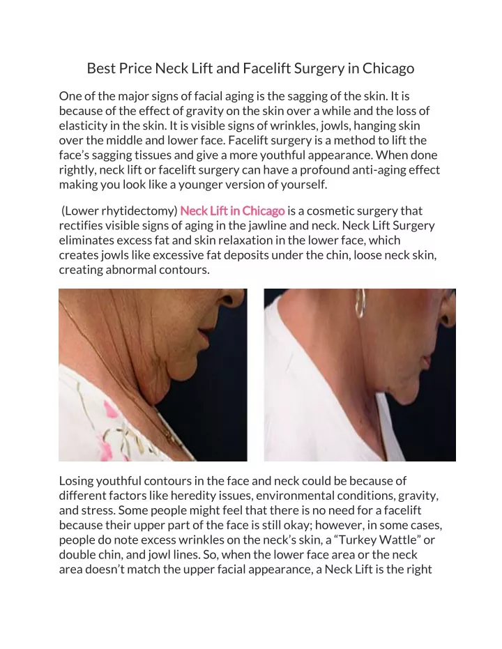 best price neck lift and facelift surgery