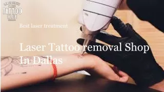 Things you should have to know before laser tattoo removal