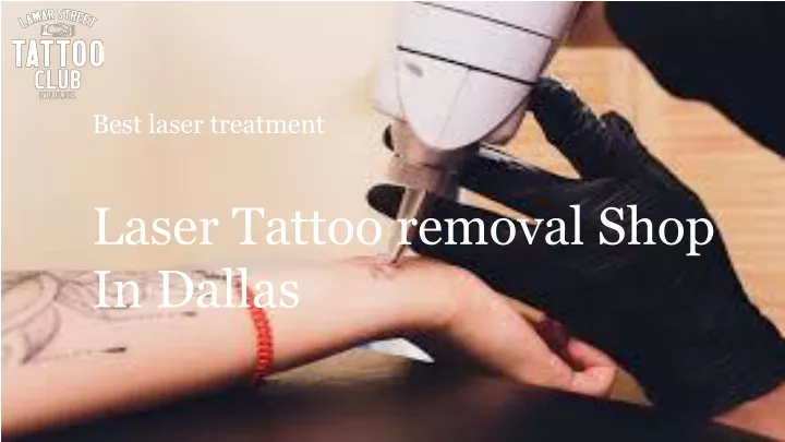 best laser treatment