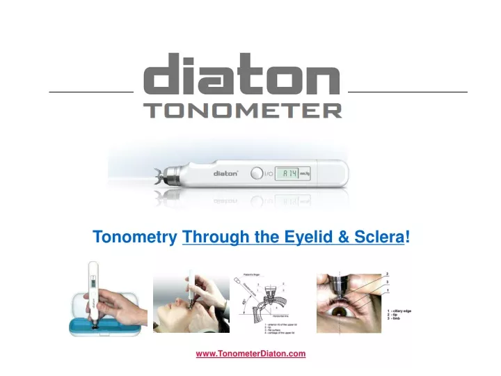 tonometry through the eyelid sclera