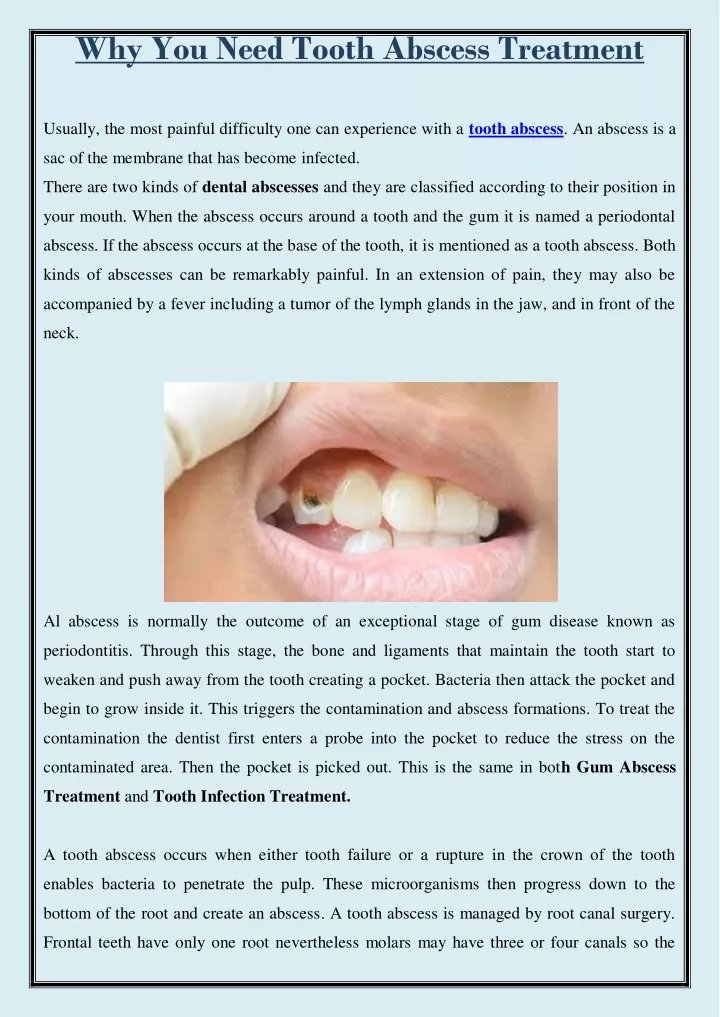 why you need tooth abscess treatment usually