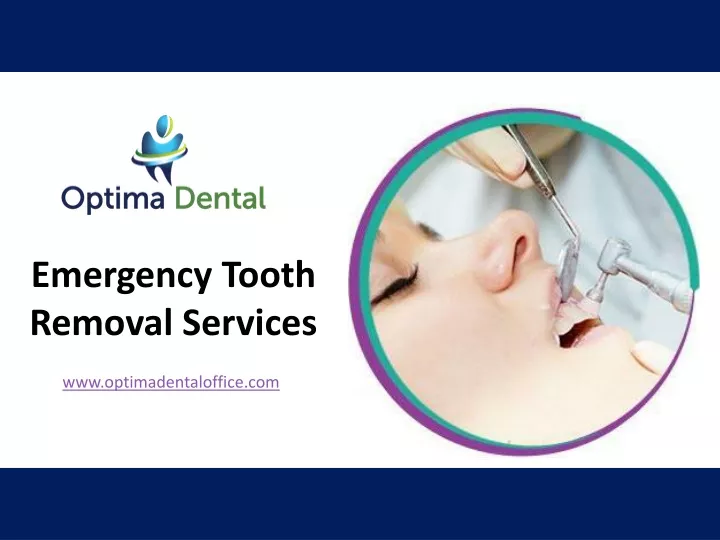 emergency tooth removal services