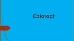 Cataract - slide 1