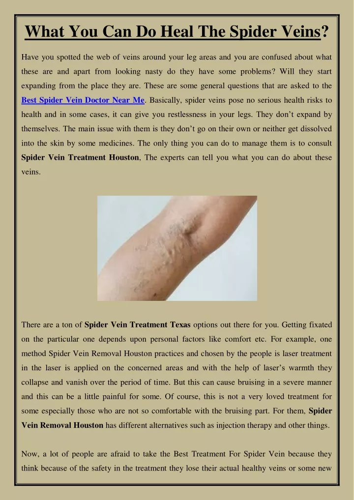 what you can do heal the spider veins