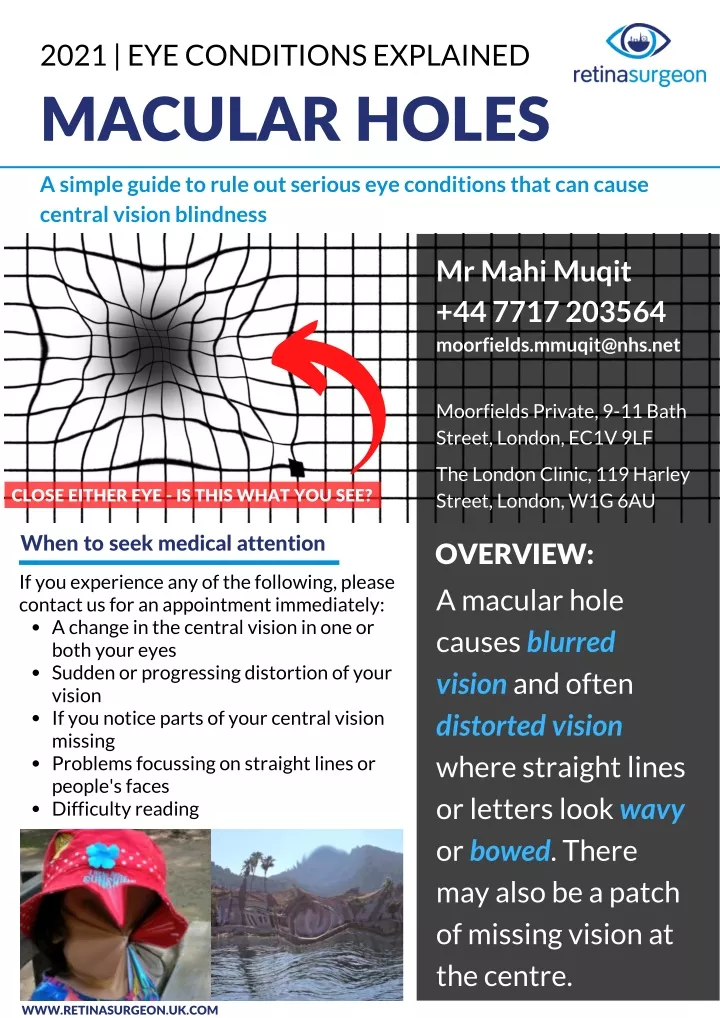 2021 eye conditions explained