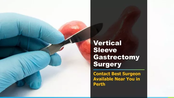 vertical sleeve gastrectomy surgery