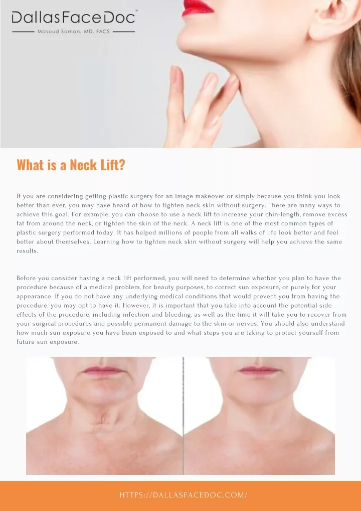 what is a neck lift