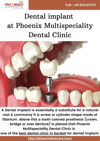 Dental implant at Phoenix Multispeciality Dental Clinic