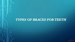 Types of Braces for Teeth