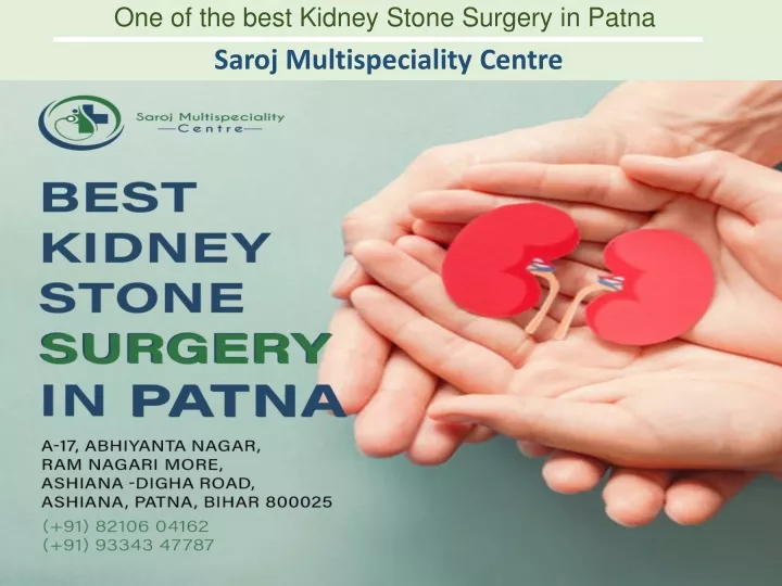 one of the best kidney stone surgery in patna