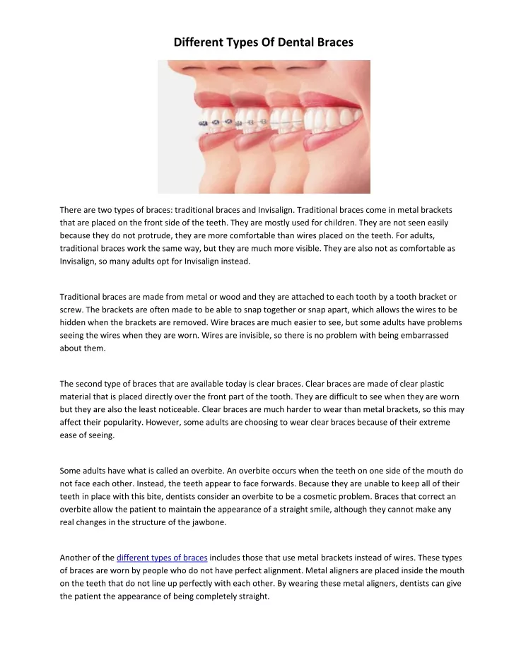 different types of dental braces