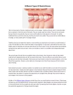Different Types Of Dental Braces