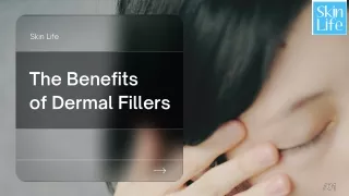 The Benefits of Dermal Fillers