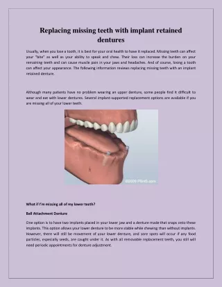 Replacing missing teeth with implant retained dentures