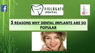 5 Reasons Why Dental Implants Are So Popular