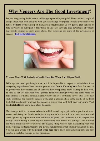 why veneers are the good investment