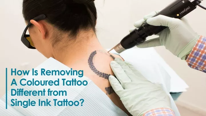 how is removing a coloured tattoo different from single ink tattoo