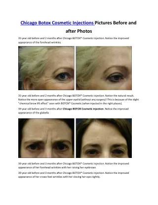 Chicago Botox Cosmetic Injections Pictures Before and After Photos