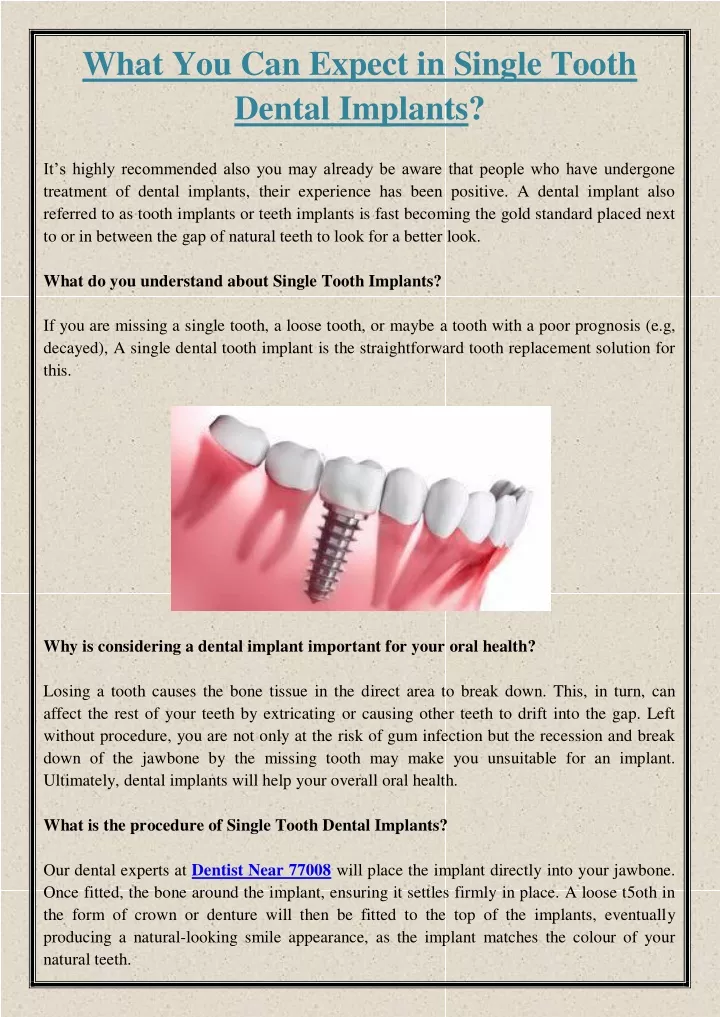 what you can expect in single tooth dental