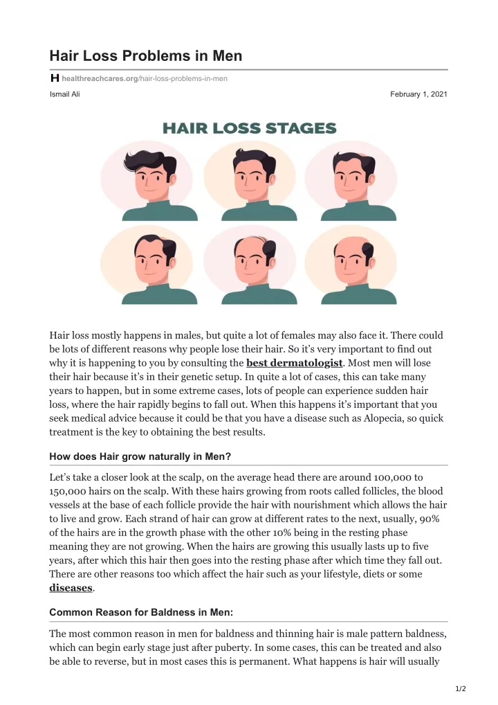 hair loss problems in men