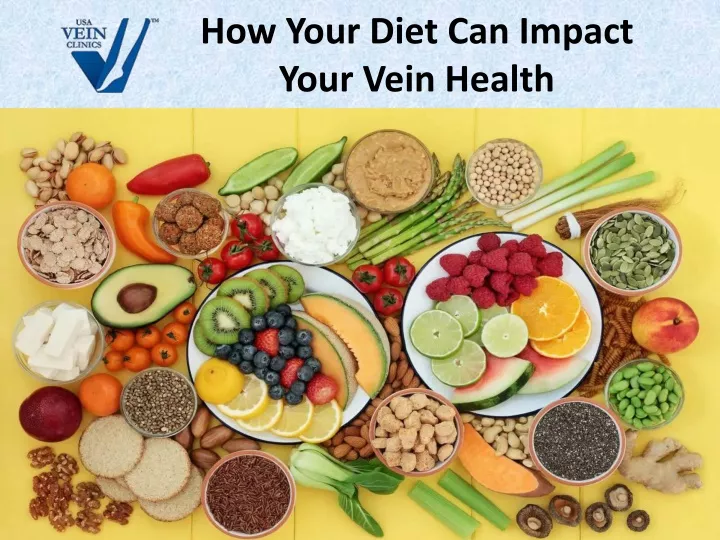 how your diet can impact your vein health
