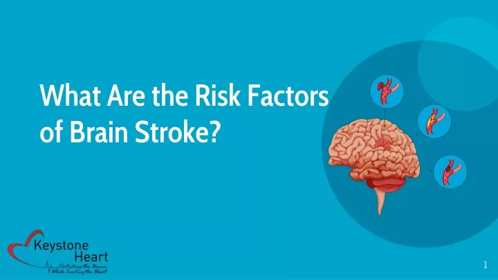 what are the risk factors of brain stroke