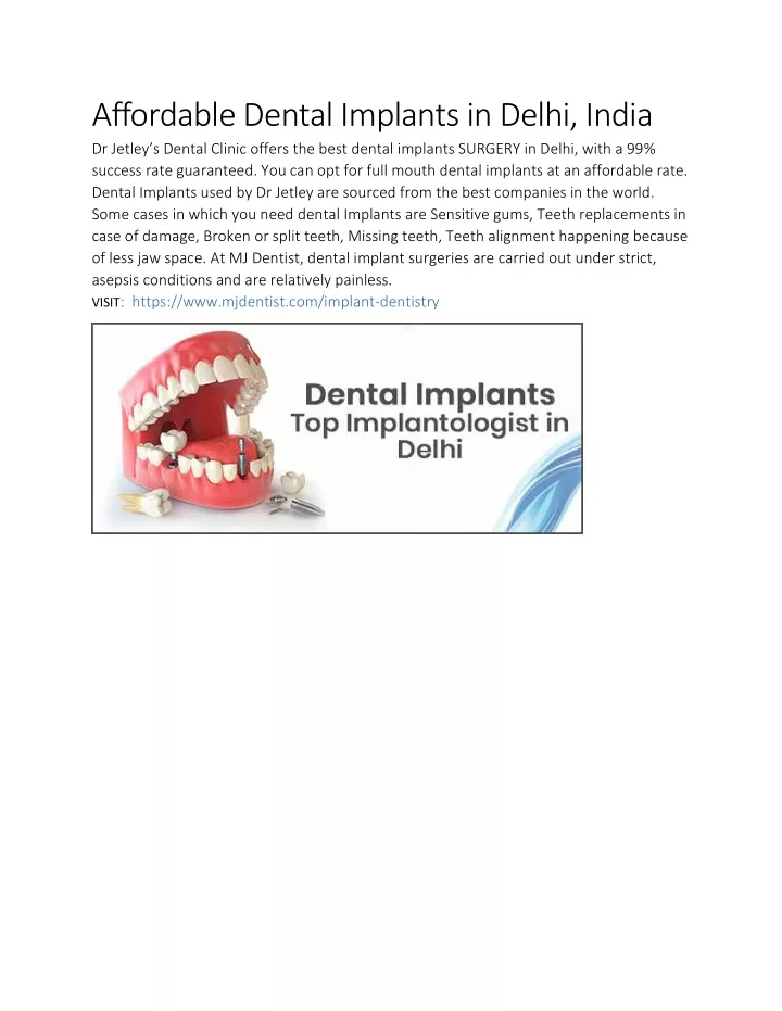 affordable dental implants in delhi india