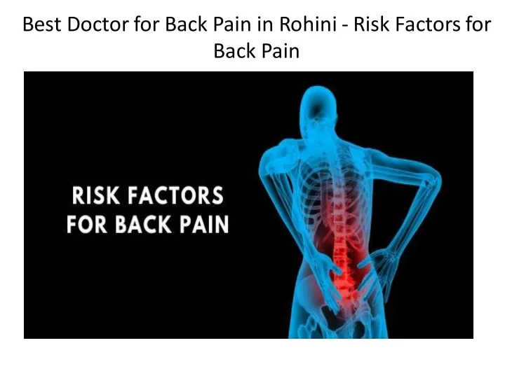 best doctor for back pain in rohini risk factors