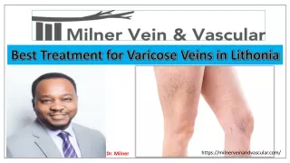 Best Treatment for Varicose Veins in Lithonia, GA