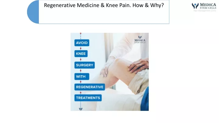 PPT - Regenerative Medicine & Knee Pain. How & Why? PowerPoint ...