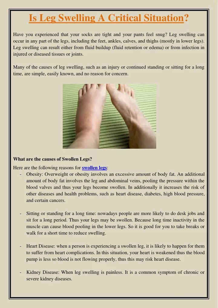 is leg swelling a critical situation